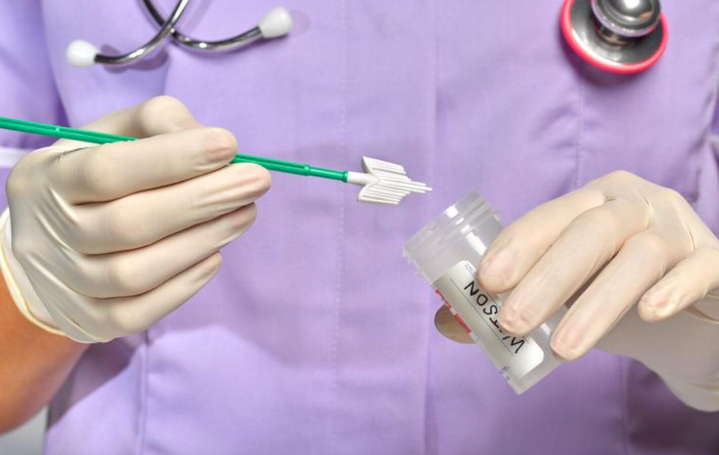 Cytologia płynna oraz HPV- w gabinecie ginekologicznym!